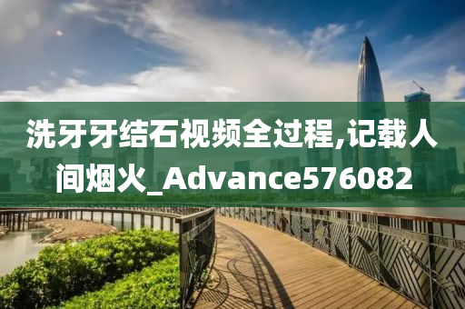 洗牙牙结石视频全过程,记载人间烟火_Advance576082